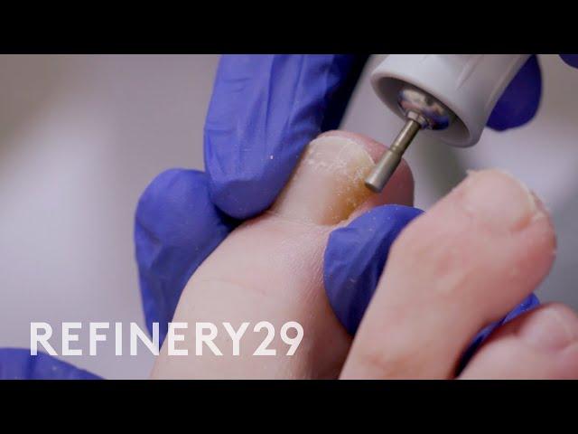 I Got a Medical Pedicure to Treat My Toenail Fungus | Macro Beauty | Refinery29