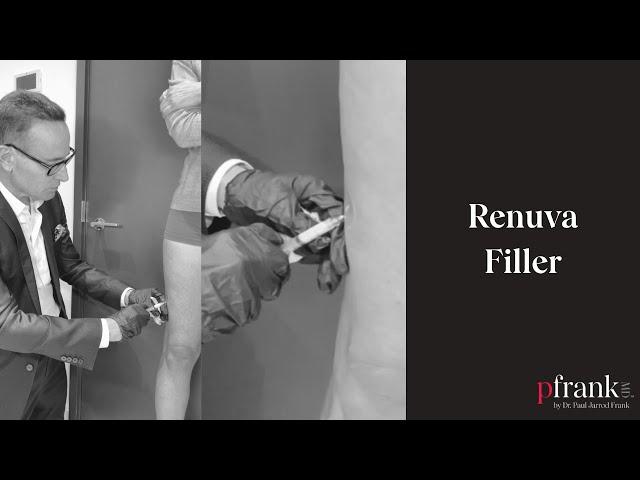 Renuva Filler - Reverse Age-Related Volume Loss