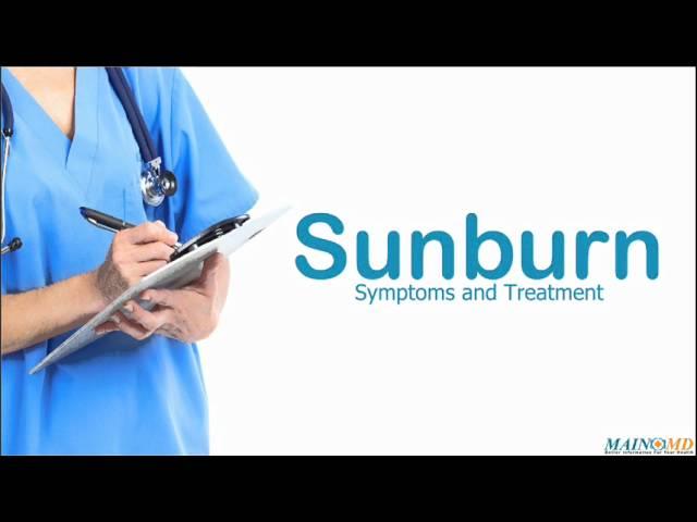 Sunburn ¦ Treatment and Symptoms