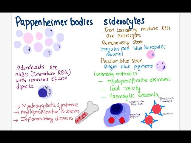 Pappenheimer bodies