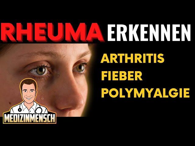 Rheuma: Symptome von Arthritis, Fieber, Polymyalgia Rheumatica (Rheumatologe erklärt)