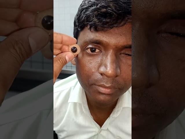 #ocularprosthesis #artificialeye #glasseye #eyeimplant #ખોટીઆંખ #fakeeye #eyelens