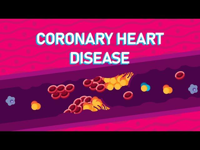 What Happens During A Heart Attack? - What is Coronary Heart Disease?