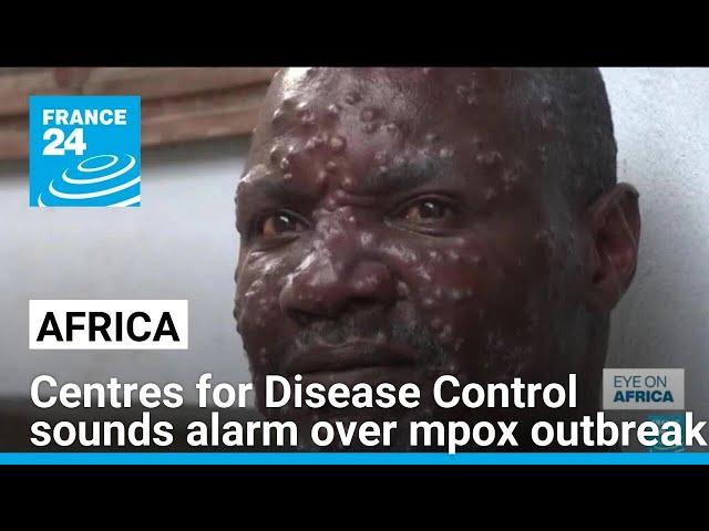 Africa's top health body sounds alarm over mpox outbreak • FRANCE 24 English