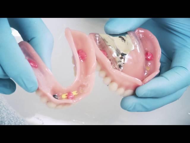Zahnprothesen  – Korrekte Anwendung von Haftcreme