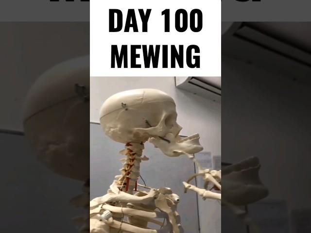 Day 100 mewing