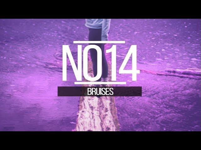 N014 Casual Chris - Bruises (Uplifting house music)