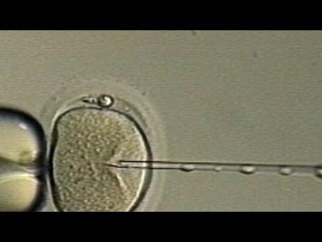 New IVF Treatment Promises Tripled Success Rate