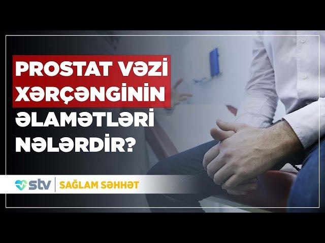 PROSTAT VƏZİ XƏRÇƏNGİNİN ƏLAMƏTLƏRİ NƏLƏRDİR?