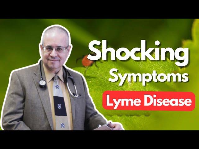 Top 2 Surprising Lyme Disease Symptoms & Manifestations You Didn't Know