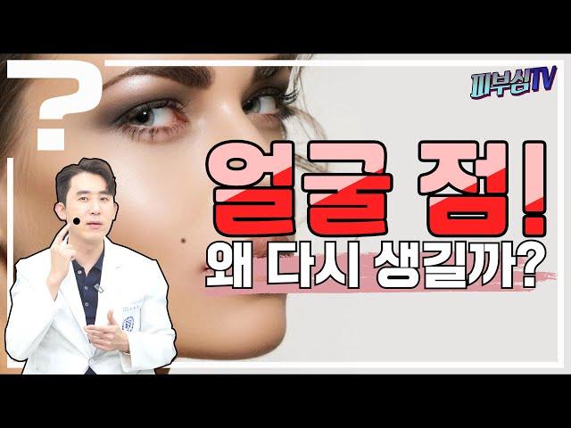 얼굴에 점? 빼도 빼도 다시 생기는 이유는? [피부과전문의 피부심]