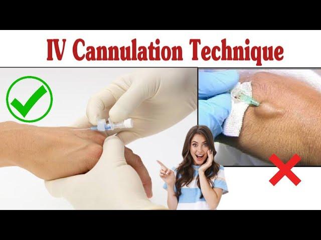 Intravenous Cannulation Technique || IV Cannula Procedure