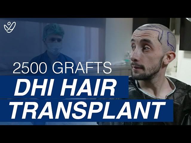 2500 Grafts DHI Hair Transplant Surgery *MUST SEE*