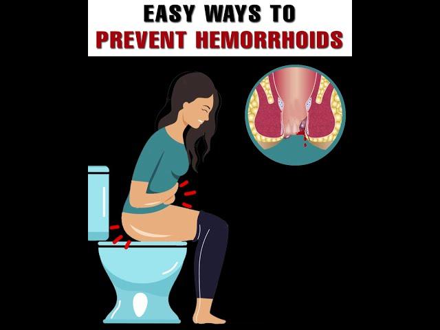 Easy Ways to Prevent Hemorrhoids | 3 Minutes Health