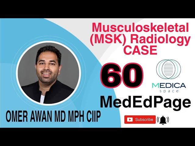 Musculoskeletal (MSK) Radiology CASE #60 @medicaspacededicatedmedica1576