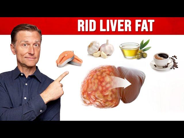 The BEST Foods for a Fatty Liver (MUST WATCH)