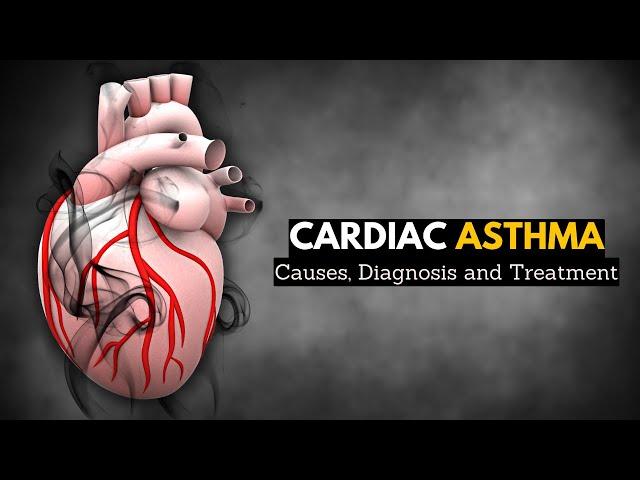 Cardiac Asthma: Causes, Signs and Symptoms, Diagnosis and Treatment