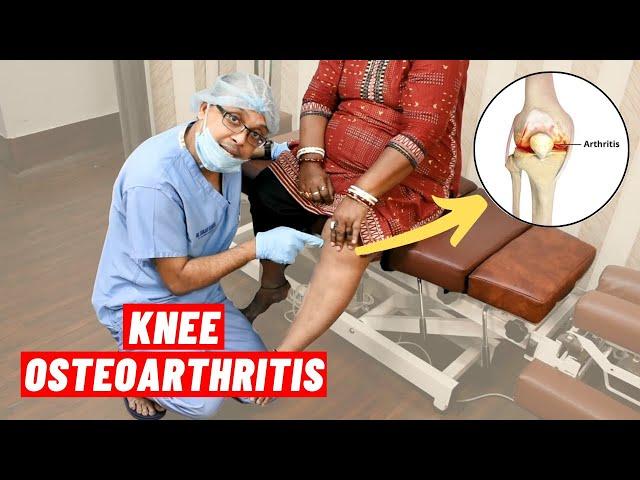 Knee Osteoarthritis Chiropractic Treatment I Dr. Sanjay Sarkar (USA) I Call 9903026262