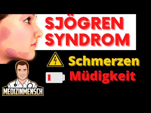 Schmerzen & Bleierne Müdigkeit Den Ganzen Tag  POLYNEUROPATHIE beim Sjögren Syndrom (Arzt erklärt)