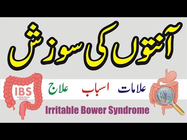 Anton ki sozish ka ilaj / Ibs (irritable bowel syndrome) / Anton ki sujan or zakhm ka ilaj in urdu.