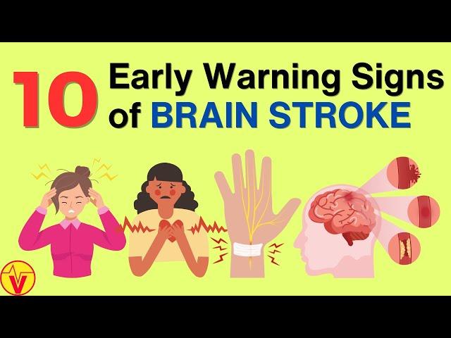 10 Warning Signs of Stroke One Month Before It Happens | VisitJoy