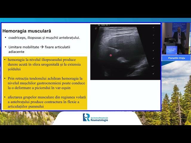 Școala de vară a tinerilor reumatologi 11 Iulie 2023 - Razvan Ionescu