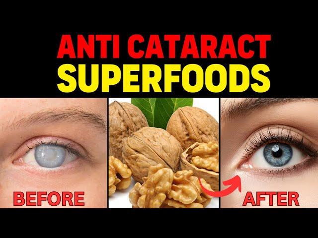 Prevent Cataracts Surgery! Top 10 Superfoods that slow down cataract| Top 5 Eye exercises.