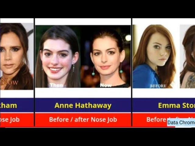 Hollywood celebrities before and after nose job #nosejobbeforeandafter #nosejobs #hollywoodcelebrity