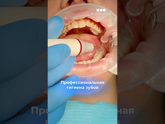 Профессиональная гигиена полости рта #чистка #гигиена #зубы #еврокаппа #eurokappa