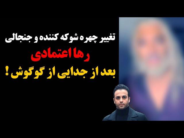 تغییر چهره شوکه کننده و جنجالی رها اعتمادی بعد از جدایی از گوگوش !