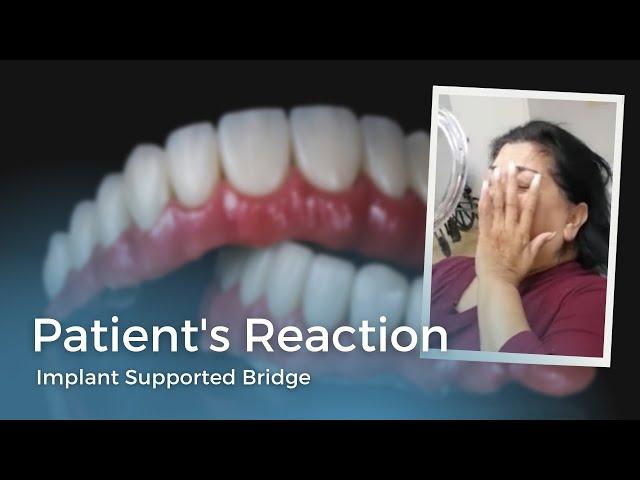 Patient Reaction Teeth Tomorrow / No More Dentures