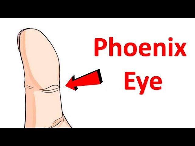 Do you have Phoenix Eye in your thumb?