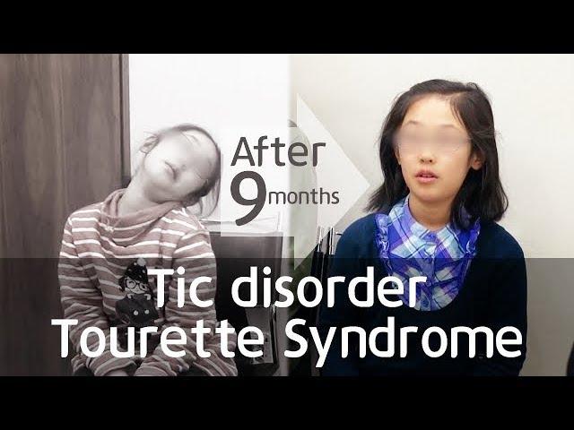 Before and after the Tourette Syndrome, Tic Disorder / 틱 뚜렛 치료사례