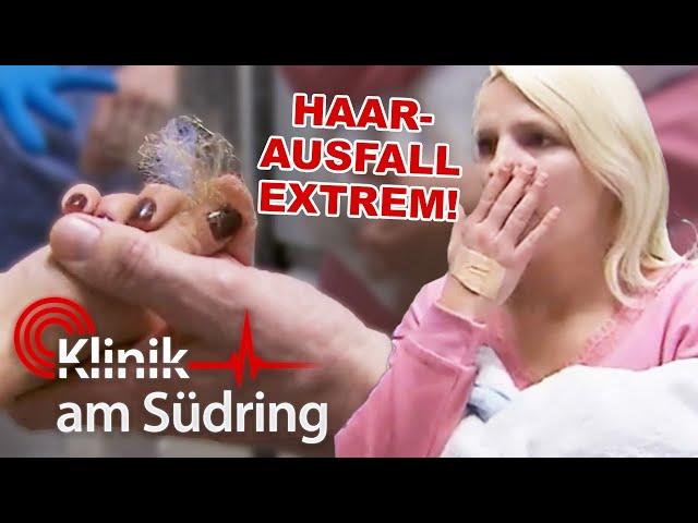 Extremer Haarausfall! Lässt sich die Besucherin untersuchen? | Klinik am Südring | SAT.1