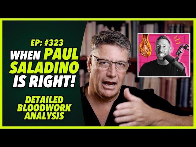 Ep:323 WHEN PAUL SALADINO IS RIGHT! Detailed bloodwork analysis - by Dr. Robert Cywes M.D. PhD