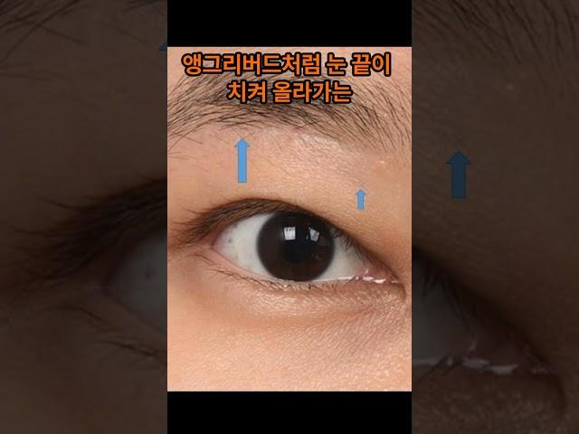젊은 눈썹하거상의 문제 - 제이제이성형외과#shorts