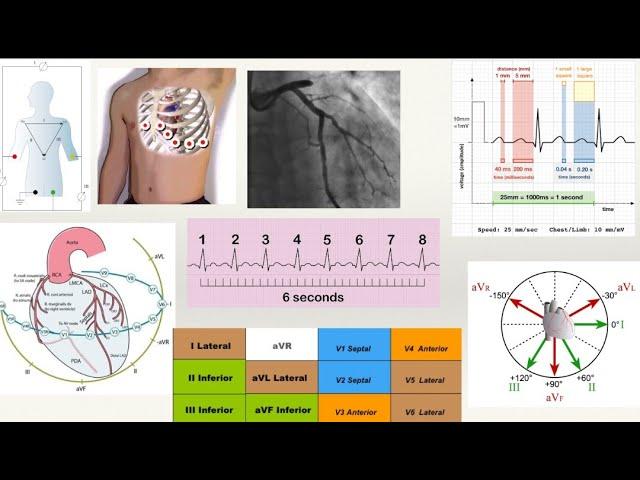 Introduction to ECG