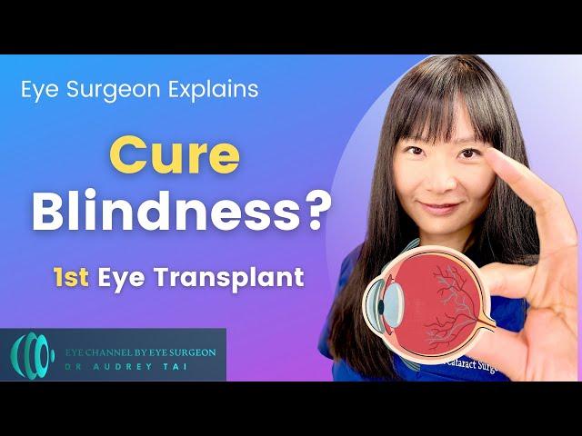 A Cure for Blindness? | World's First Eye Transplant | Eye Surgeon Explains #draudreytai