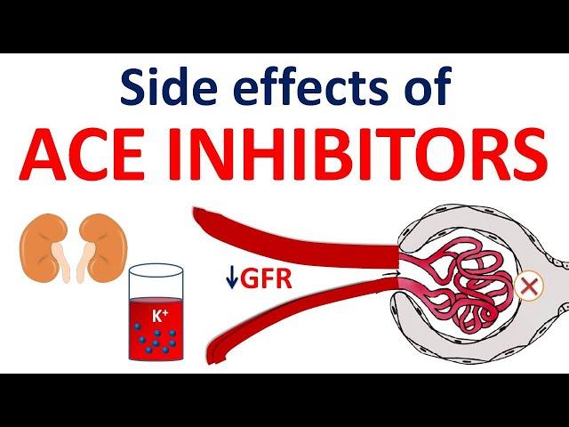 Side effects of ACE Inhibitors