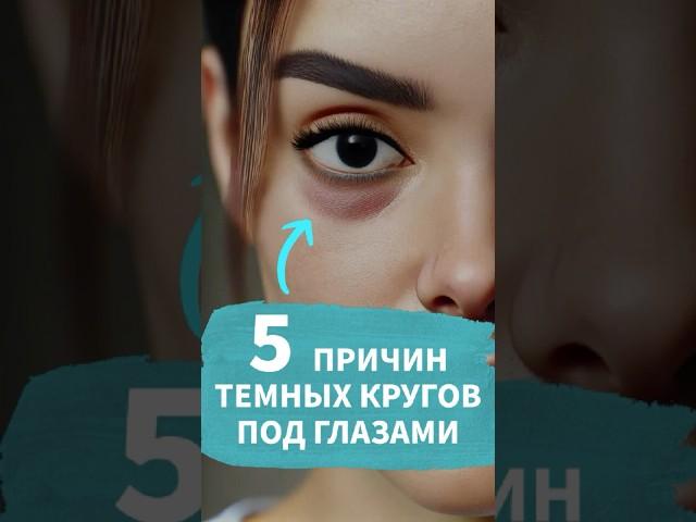 ТЕМНЫЕ КРУГИ ПОД ГЛАЗАМИ