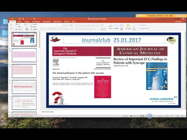 Ecg Vlog Syncope on Ecg Part 1, 2017