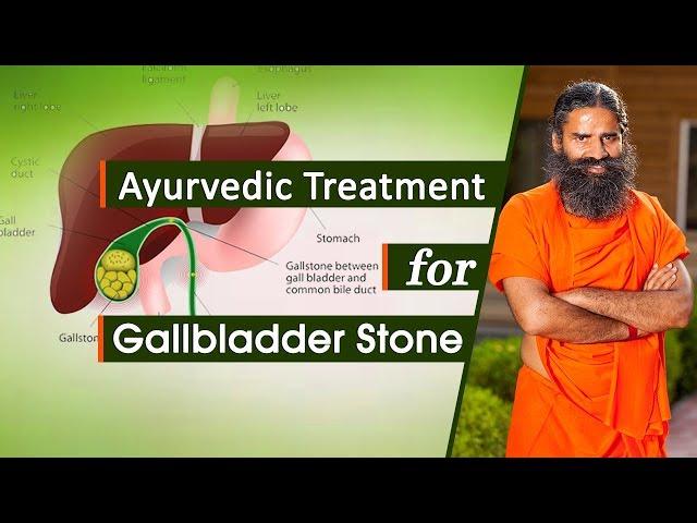 Ayurvedic Treatment for Gallbladder Stone | Swami Ramdev