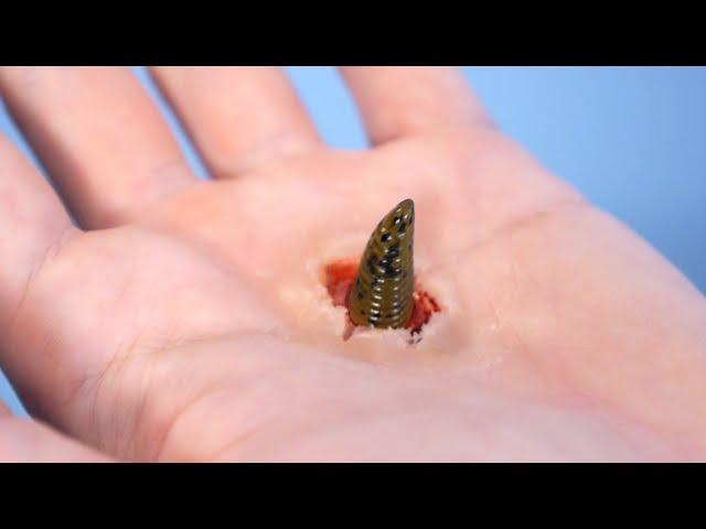 WORM EATS WAY OUT OF SKIN!