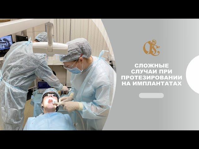 Сложные случаи при протезировании на имплантатах . Гильдия стоматологов- стоматология в Петербурге