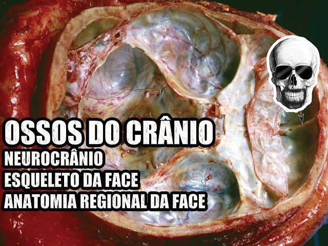 Ossos do Crânio: Neurocrânio e Esqueleto da Face - Anatomia Humana - VideoAula 136 -