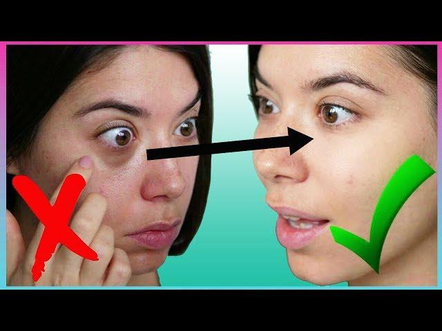 7 HACKS FOR UNDER EYE BAGS & DARK CIRCLES | Adriana Spink