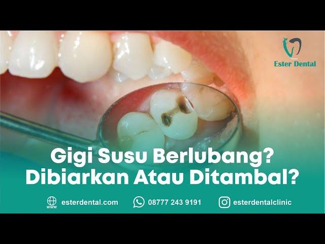 Gigi Susu Yang Berlubang Harus Dibiarkan Atau Ditambal?