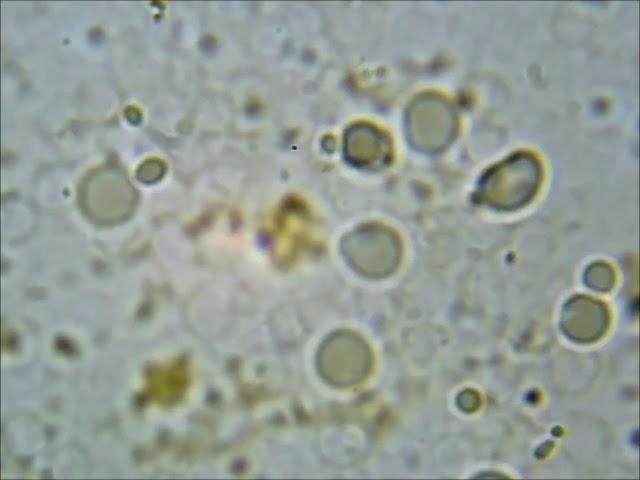 Spirochetes turn into L forms or spheroplasts