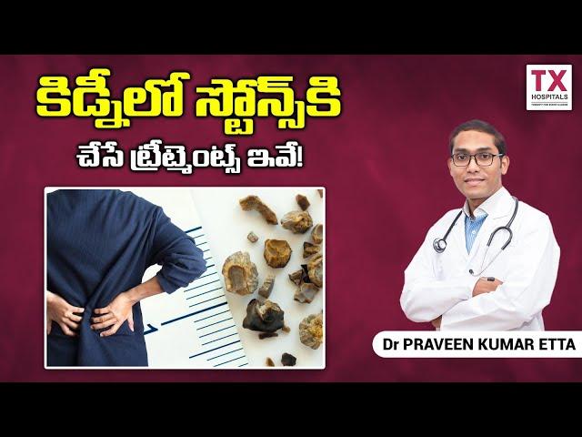 Treatment for Kidney Stones: Surgical and Medical Treatment Options Explained || TX Hospitals