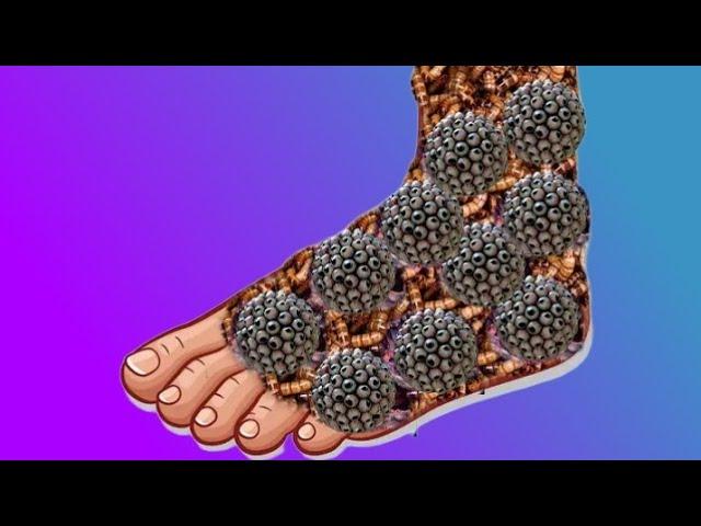 ASMR Animation Treatment Infected Leg | ASMR Collection | 2D ASMR Animation Treatment  @BiswaAsmr